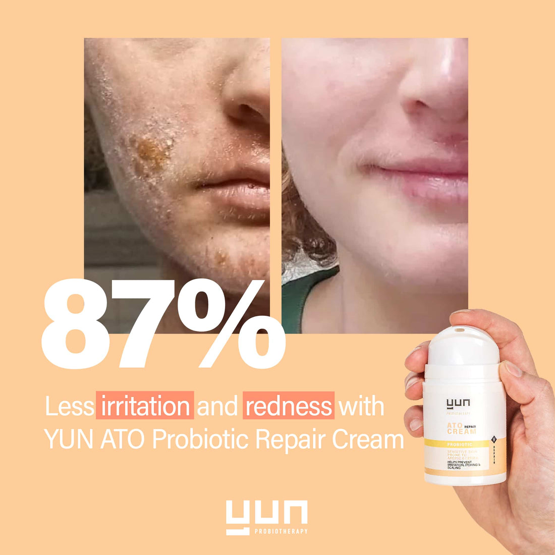 YUN ATO PROBIOTIC REPAIR Crème 50ml